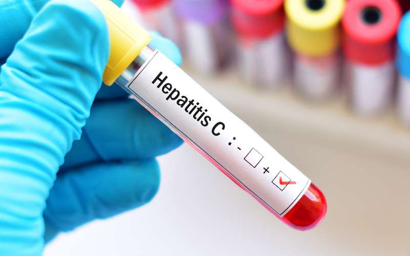 HEPATITIS C causes, symptoms types prevention and treatment