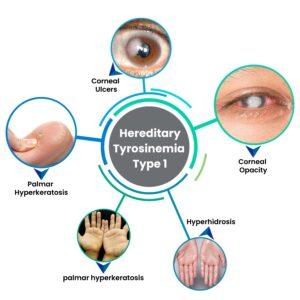 Hereditary Tyrosinemia Type 1